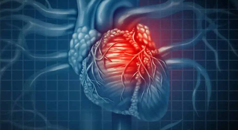 Habitual Marijuana Use Linked to Higher Heart Disease Risk in New Study