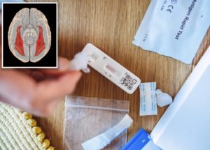 Long COVID Patient Develops Face Blindness
