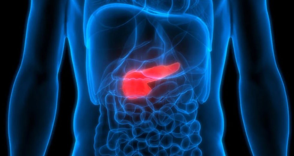 Revolutionary New Study Finds Treatment for One of the Deadliest Cancers