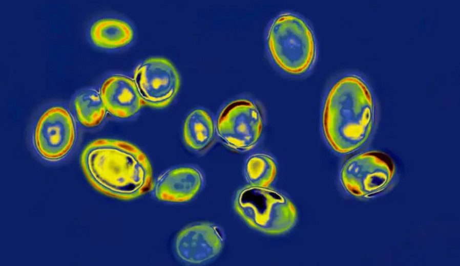 “Urgent Threat” Fungus Continues to Spread – Here’s What Experts Have to Say!