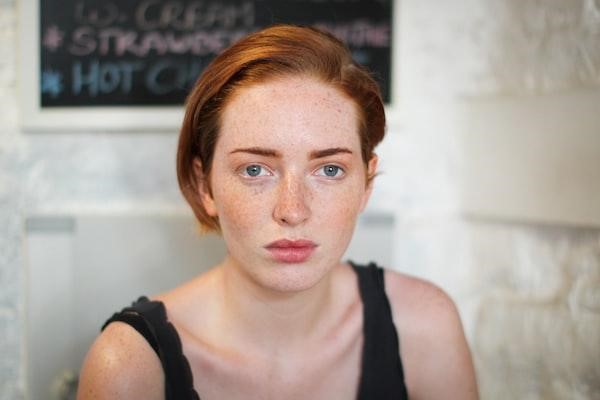 The Ins and Outs of Microneedling