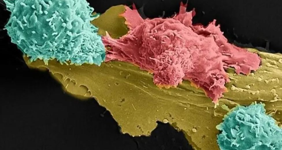 Revolutionary New Cancer Treatment is 90% Efficient!