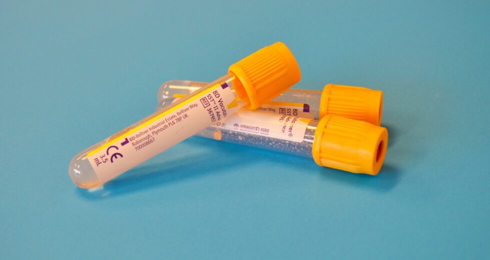 3 Urine Kits To Successfully Pass a Drug Test; Pros and Cons Revealed