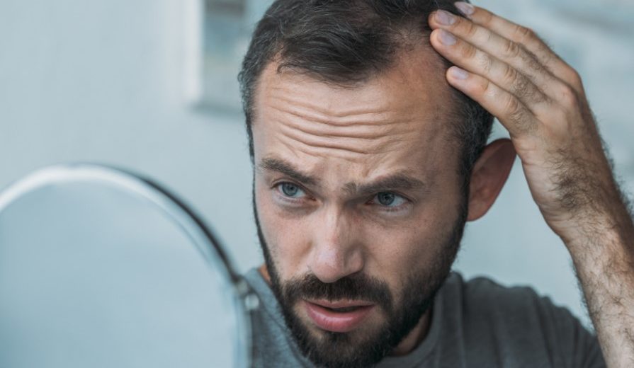 Stem Cells Used to Cure Male Baldness in New Study