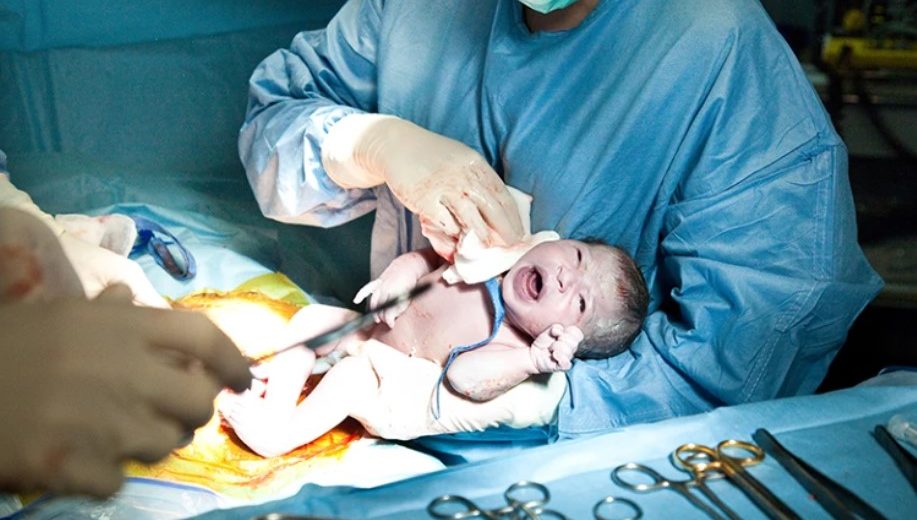 Microbes Swabbed from the Mother at Birth Can Speed Up C-Section Babies’ Brain Development, Study Finds