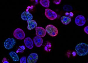Cancer Patients Can Have Better Lives After DNA Sequencing