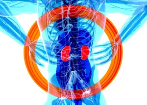 New Treatment For Hyperkalemia and Other Options That Seem Efficient Disclosed