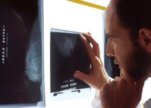 What Exactly is the Prostatic Artery Embolization (PAE) – Key Facts Everyone Should Know