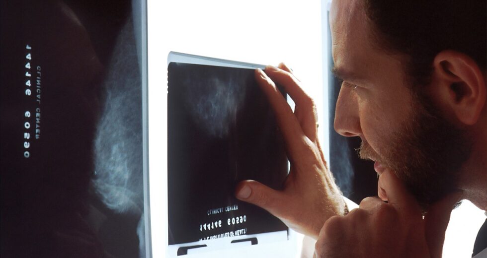 What Exactly is the Prostatic Artery Embolization (PAE) – Key Facts Everyone Should Know