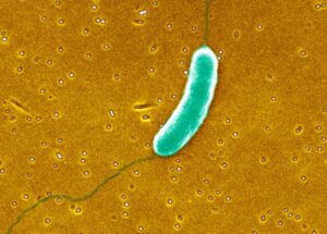 How to Protect Yourself From Flesh-eating Bacteria; Scientists Warn Us