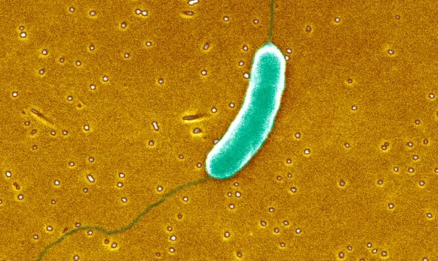 How to Protect Yourself From Flesh-eating Bacteria; Scientists Warn Us