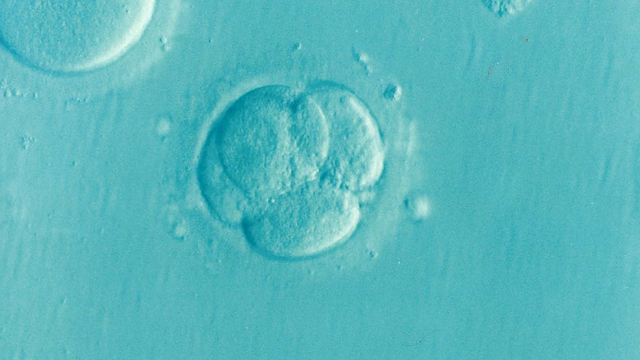 Can Tunica Vaginalis Problems Lead to Infertility?
