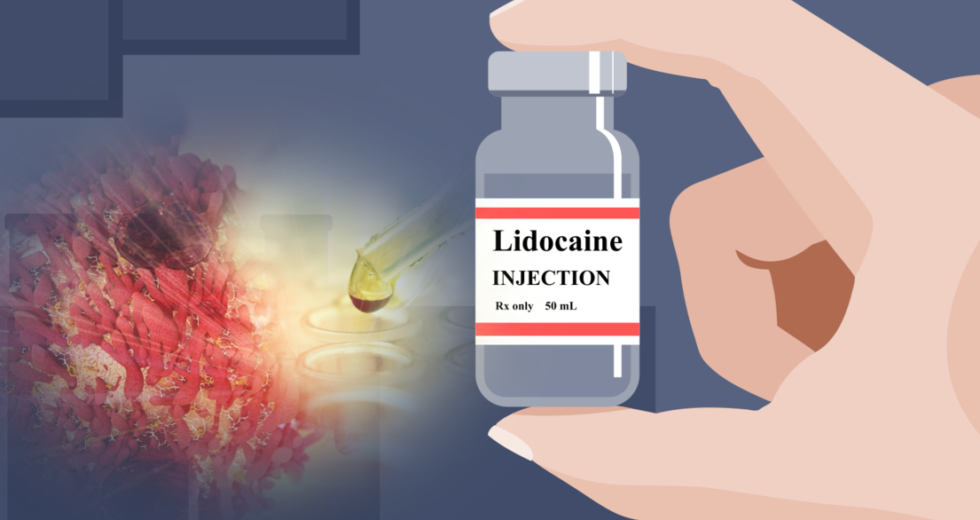 Anesthetic Kills Cancer Cells With Unique Mechanisms