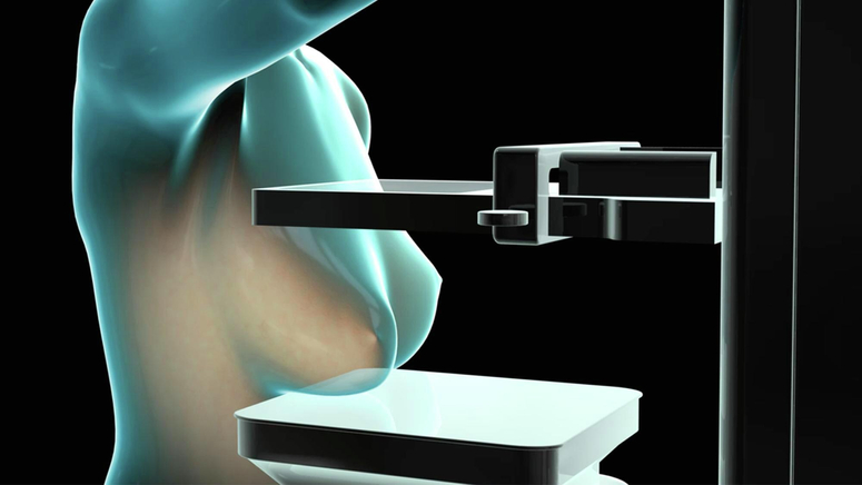 Mammography Named “The Biggest Organized Crime Against Women” – Swiss Medical Board Recommends Ban