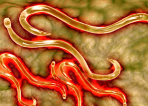 Parasite Infection Can Be Cured With Natural Remedies