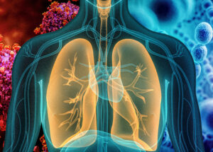 Here’s How To Prevent Pneumonia During Hospital Stays