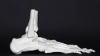 Footing the Bill: Overcoming Common Foot and Ankle Injuries